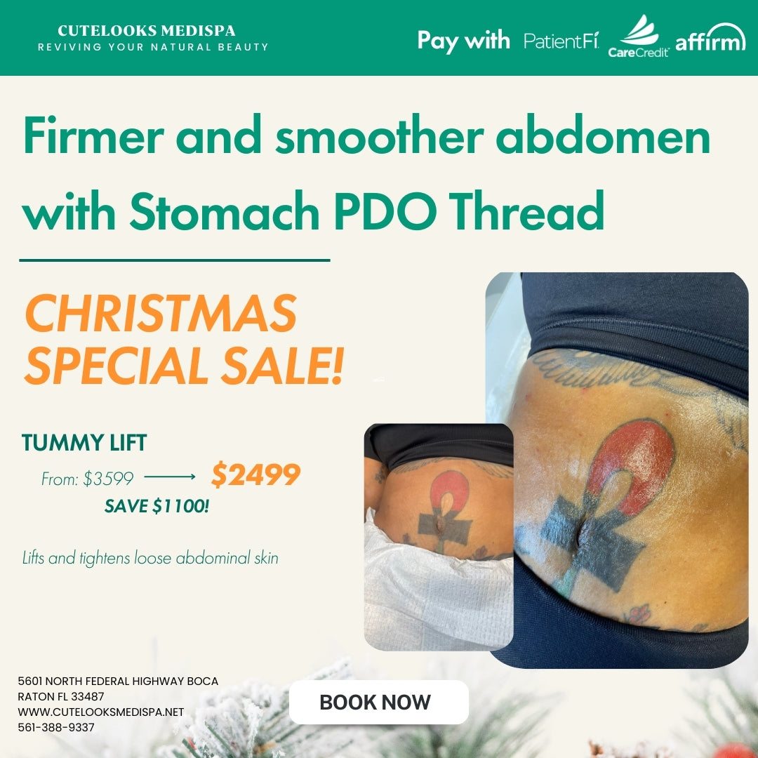 Abdomen Pdo Thread Treatment